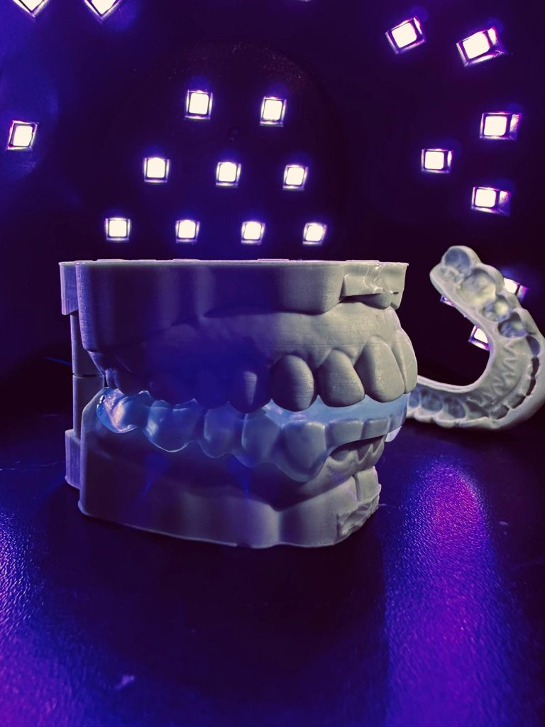 Gouttières d'alignements sur un modele 3d